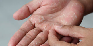 How to Remove Nail Glue from Skin: Quick and Easy Solutions How To Get Nail Glue Off Skin