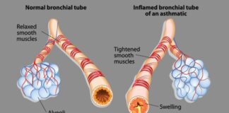 How Does Asthma Affect The Respiratory System