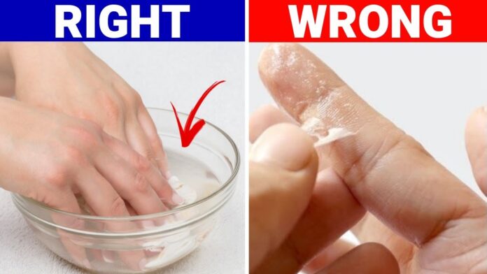 How To Get Super Glue Off Skin