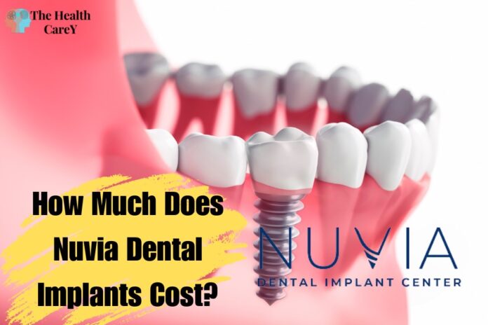 How Much Does Nuvia Dental Implants Cost? What You Need to Know