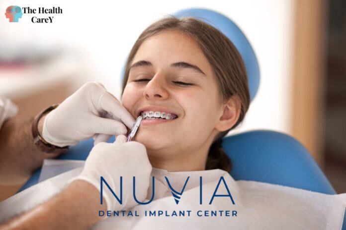 Nuvia Dental Implant Center Reviews: What Patients Are Saying