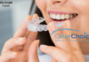 Pros and Cons of Clear Choice Dental Implants Clear Choice Dental Implants: Pros and Cons Explained