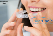 Pros and Cons of Clear Choice Dental Implants Clear Choice Dental Implants: Pros and Cons Explained