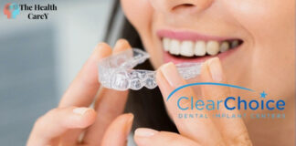 Pros and Cons of Clear Choice Dental Implants Clear Choice Dental Implants: Pros and Cons Explained
