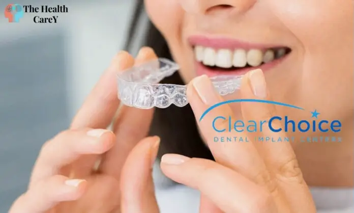 Clear Choice Dental Implants: Pros and Cons Explained
