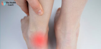 How to Dissolve Bone Spurs Naturally: Effective Methods and Tips How to Dissolve Bone Spurs Naturally: Effective Methods and Tips