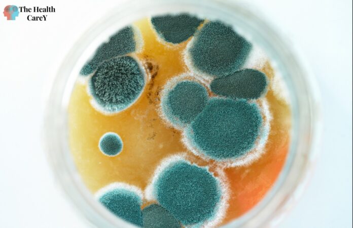 10 Warning Signs of Mold Toxicity: Recognizing the Symptoms