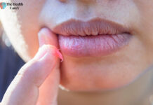 How to Heal Cracked Lip Corners Fast: Tips and Remedies How to Heal Cracked Lip Corners Fast: Tips and Remedies