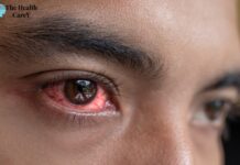 Can You Get Pink Eye from a Fart? Exploring the Possibility Can You Get Pink Eye from a Fart? Exploring the Possibility