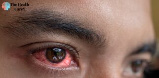 Can You Get Pink Eye from a Fart? Exploring the Possibility Can You Get Pink Eye from a Fart? Exploring the Possibility